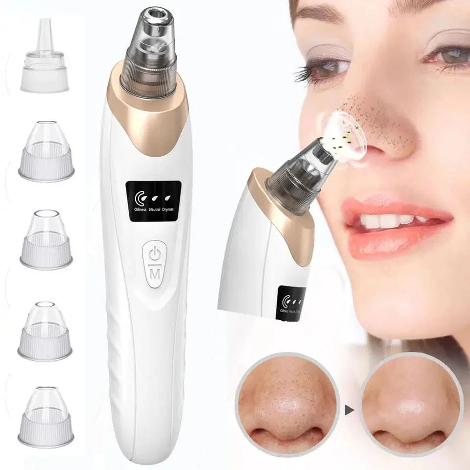Blackhead Remover Vacuum